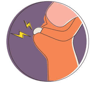 Illustration of chest pain, highlighted in red colour.
