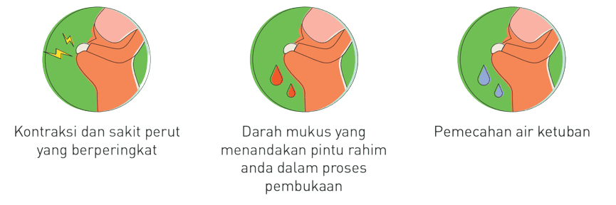 Three icons showing stages of labour progression.