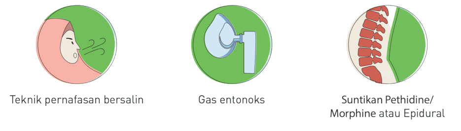 Labour pain relief methods illustration.